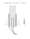 ADAPTABLE DEVICE FOR DETECTING AND TREATING DENTAL PATHOLOGIES diagram and image