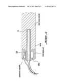 ADAPTABLE DEVICE FOR DETECTING AND TREATING DENTAL PATHOLOGIES diagram and image