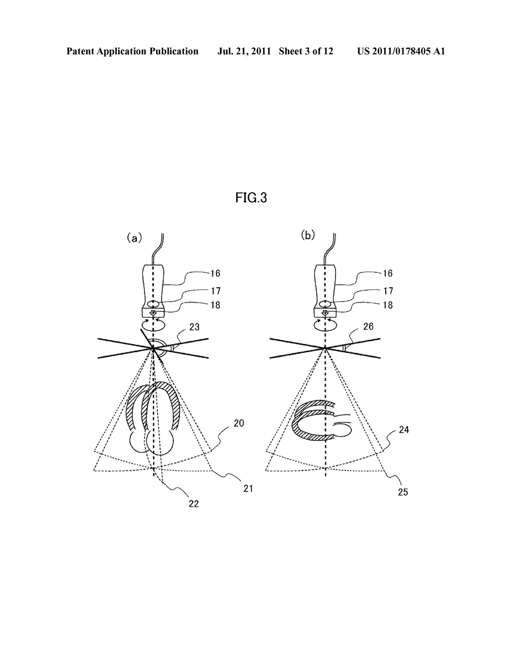 ULTRASONIC DIAGNOSTIC APPARATUS AND IMAGE PROCESSING APPARATUS FOR     ULTRASONIC DIAGNOSIS - diagram, schematic, and image 04