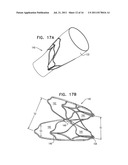 DEVICES AND METHODS FOR CONTROL OF BLOOD PRESSURE diagram and image