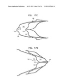 DEVICES AND METHODS FOR CONTROL OF BLOOD PRESSURE diagram and image