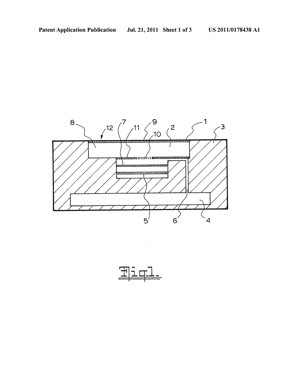 IMPLANTABLE MICROPHONE DEVICE - diagram, schematic, and image 02