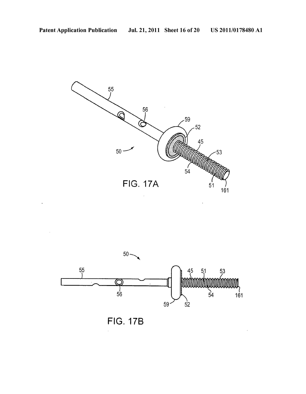 Shunt Apparatus For Treating Obesity By Extracting Food - diagram, schematic, and image 17