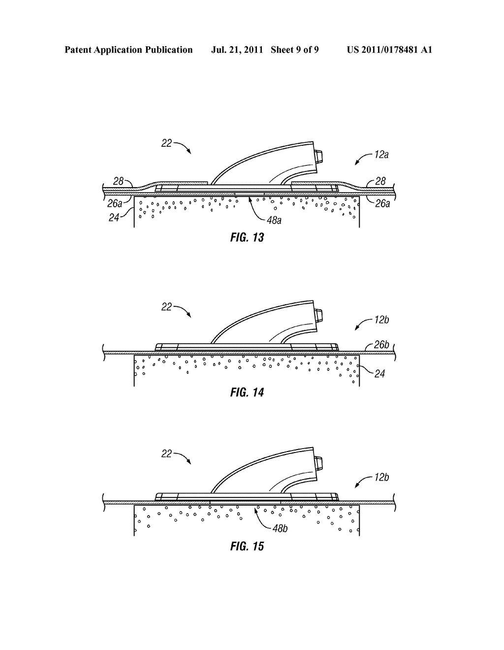 Wound-Connection Pads For Fluid Instillation and Negative Pressure Wound     Therapy, and Systems and Methods - diagram, schematic, and image 10