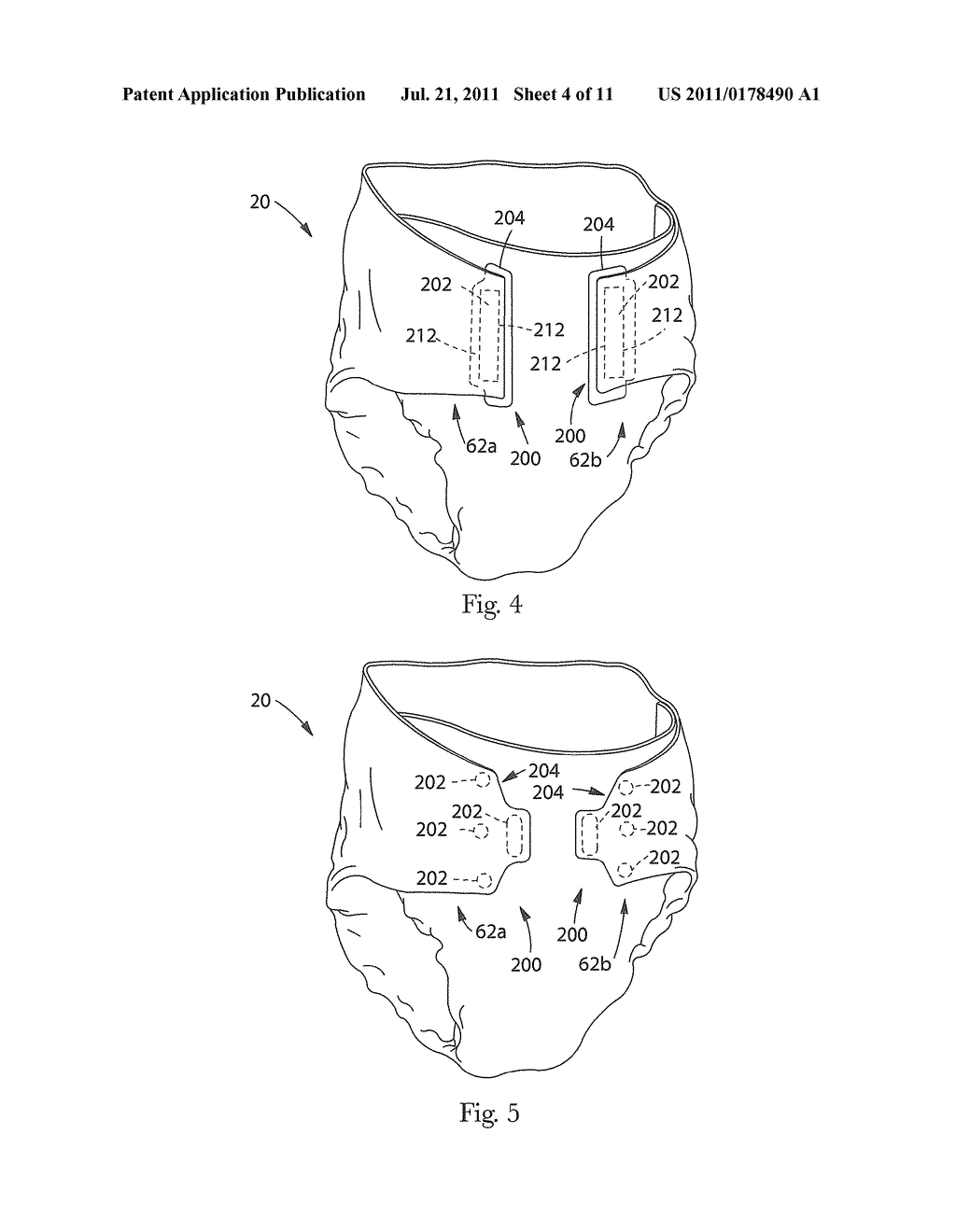 Refastenable Absorbent Article - diagram, schematic, and image 05