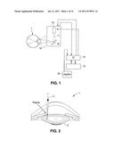 METHOD AND APPARATUS FOR PATTERNED PLASMA-MEDIATED LASER TREPHINATION OF     THE LENS CAPSULE AND THREE DIMENSIONAL PHACO-SEGMENTATION diagram and image