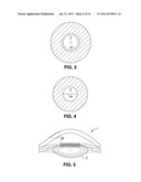 METHOD AND APPARATUS FOR PATTERNED PLASMA-MEDIATED LASER TREPHINATION OF     THE LENS CAPSULE AND THREE DIMENSIONAL PHACO-SEGMENTATION diagram and image