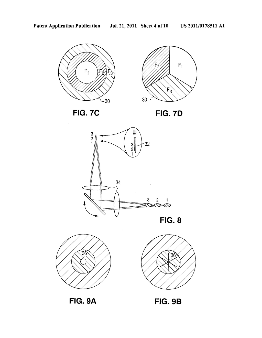 METHOD AND APPARATUS FOR PATTERNED PLASMA-MEDIATED LASER TREPHINATION OF     THE LENS CAPSULE AND THREE DIMENSIONAL PHACO-SEGMENTATION - diagram, schematic, and image 05