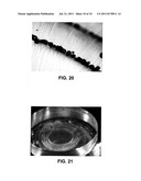 METHOD AND APPARATUS FOR PATTERNED PLASMA-MEDIATED LASER TREPHINATION OF     THE LENS CAPSULE AND THREE DIMENSIONAL PHACO-SEGMENTATION diagram and image