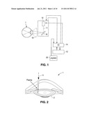 METHOD AND APPARATUS FOR PATTERNED PLASMA-MEDIATED LASER TREPHINATION OF     THE LENS CAPSULE AND THREE DIMENSIONAL PHACO-SEGMENTATION diagram and image