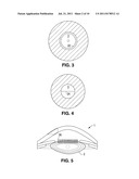 METHOD AND APPARATUS FOR PATTERNED PLASMA-MEDIATED LASER TREPHINATION OF     THE LENS CAPSULE AND THREE DIMENSIONAL PHACO-SEGMENTATION diagram and image