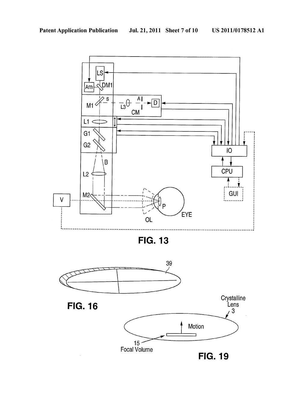 METHOD AND APPARATUS FOR PATTERNED PLASMA-MEDIATED LASER TREPHINATION OF     THE LENS CAPSULE AND THREE DIMENSIONAL PHACO-SEGMENTATION - diagram, schematic, and image 08