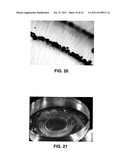 METHOD AND APPARATUS FOR PATTERNED PLASMA-MEDIATED LASER TREPHINATION OF     THE LENS CAPSULE AND THREE DIMENSIONAL PHACO-SEGMENTATION diagram and image