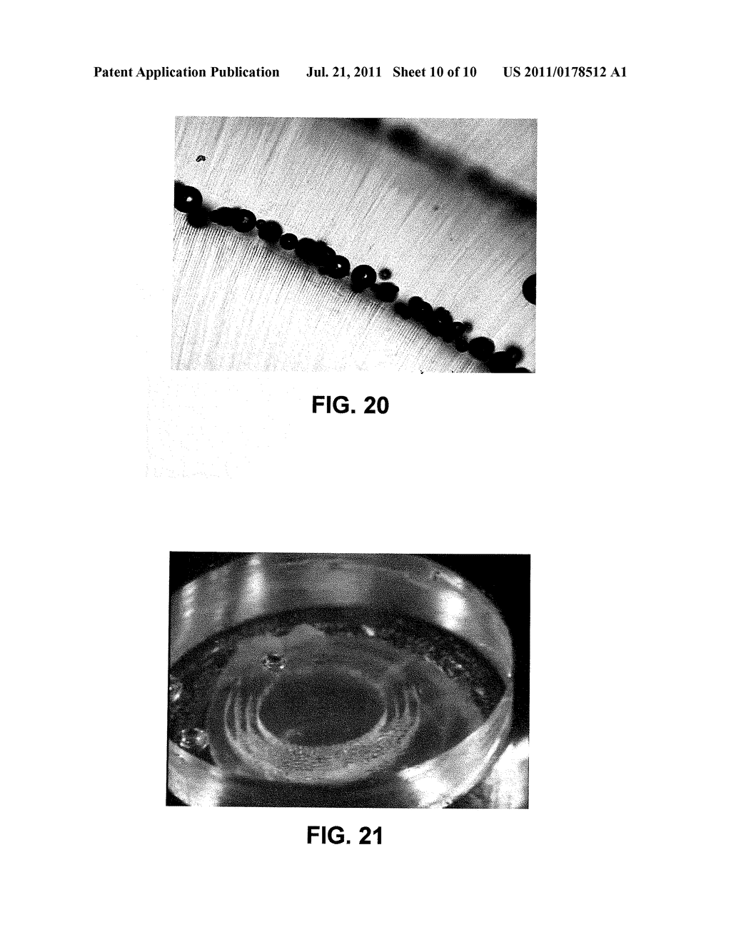 METHOD AND APPARATUS FOR PATTERNED PLASMA-MEDIATED LASER TREPHINATION OF     THE LENS CAPSULE AND THREE DIMENSIONAL PHACO-SEGMENTATION - diagram, schematic, and image 11