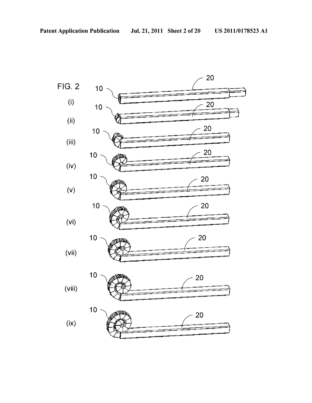 TOOL AND CORRESPONDING METHOD FOR REMOVAL OF MATERIAL FROM WITHIN A BODY - diagram, schematic, and image 03