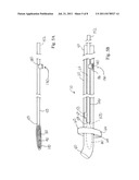 Opthalmic Lens Capsule Support diagram and image