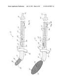 Opthalmic Lens Capsule Support diagram and image