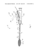 Opthalmic Lens Capsule Support diagram and image