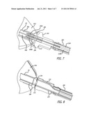 GASTRIC SPACE FILLER DELIVERY SYSTEM AND RELATED METHODS diagram and image