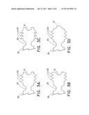 DEVICE AND METHOD FOR CLOSURE OF VESSEL ACCESS SITE diagram and image