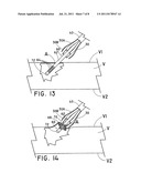 DEVICE AND METHOD FOR CLOSURE OF VESSEL ACCESS SITE diagram and image