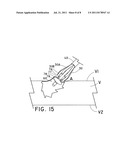 DEVICE AND METHOD FOR CLOSURE OF VESSEL ACCESS SITE diagram and image