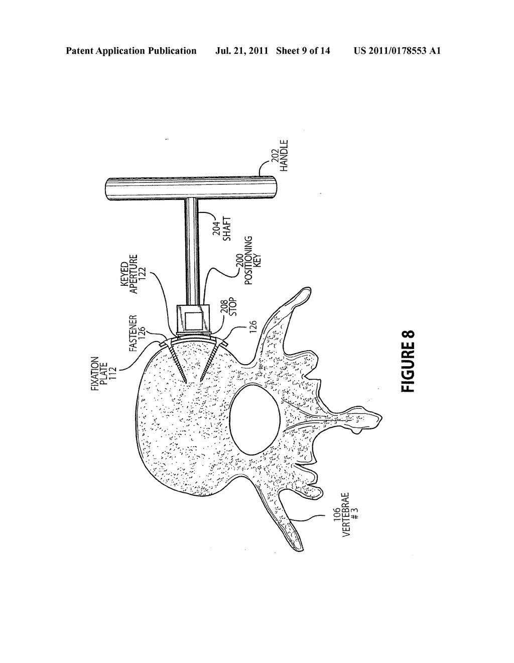 METHOD AND APPARATUS FOR LATERAL REDUCTION AND FUSION OF THE SPINE - diagram, schematic, and image 10