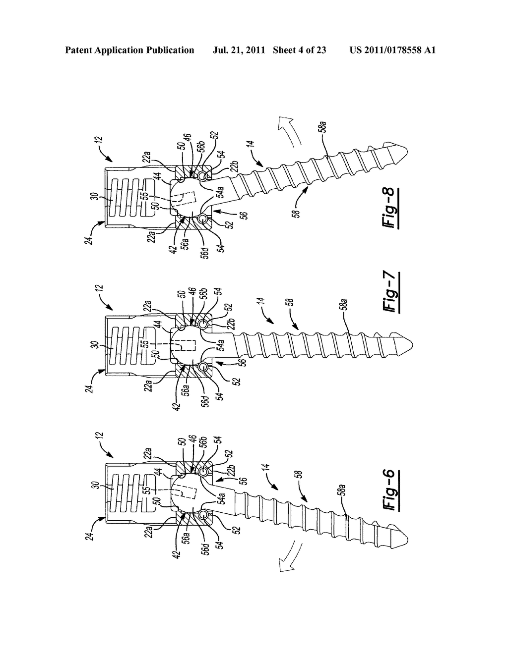 UNIPLANAR BONE ANCHOR SYSTEM - diagram, schematic, and image 05