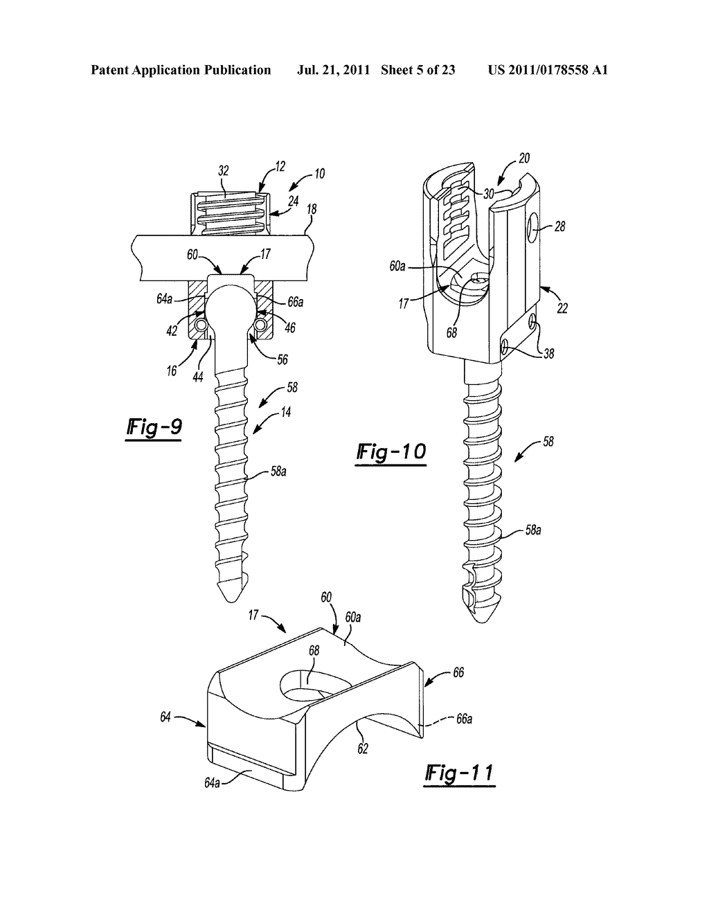 UNIPLANAR BONE ANCHOR SYSTEM - diagram, schematic, and image 06