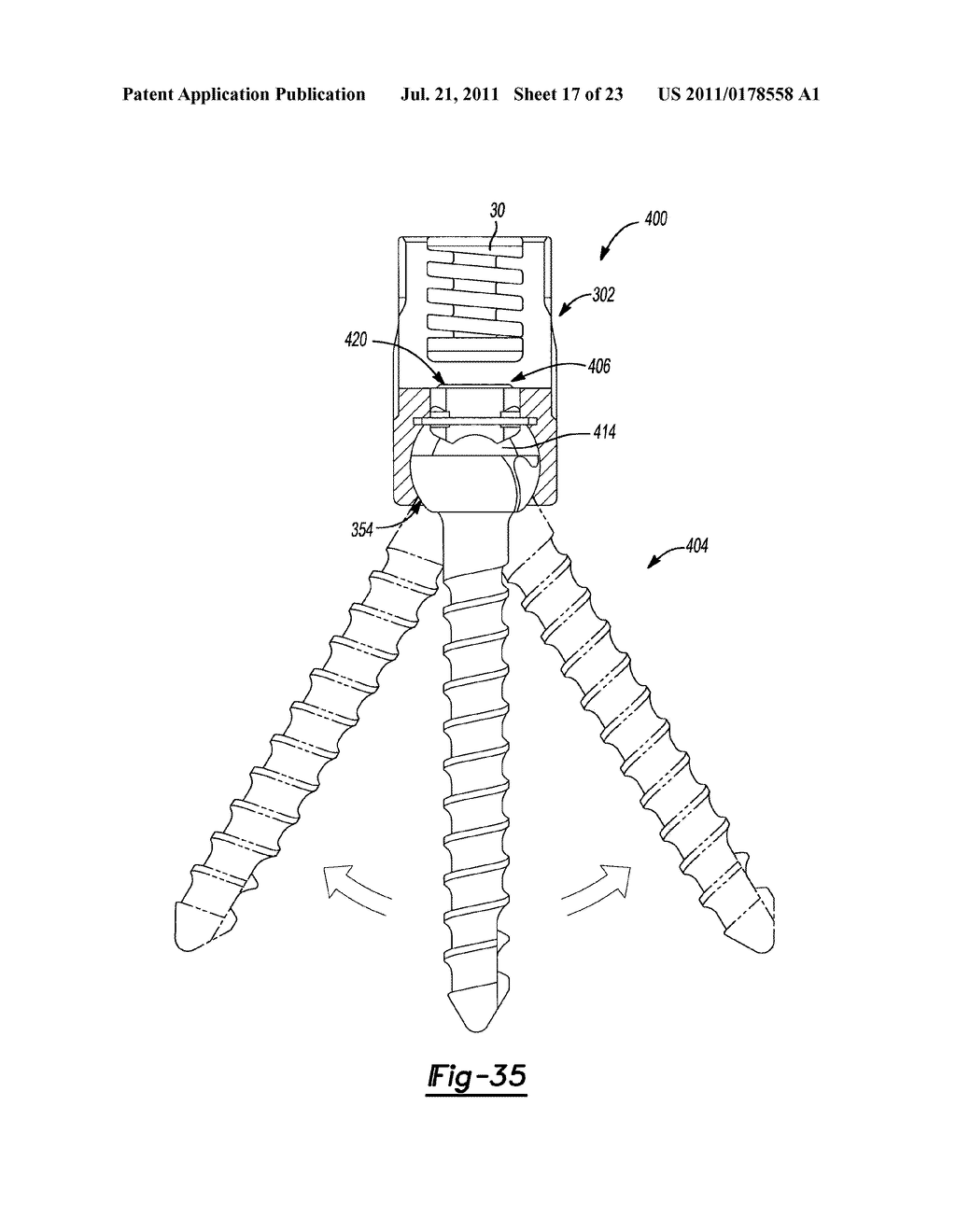 UNIPLANAR BONE ANCHOR SYSTEM - diagram, schematic, and image 18