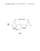 METHOD AND APPARATUS FOR SELECTING AND TIMING ANTI-TACHYARRHYTHMIA PACING     USING CARDIAC SIGNAL MORPHOLOGY diagram and image