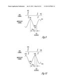 METHOD AND APPARATUS FOR SELECTING AND TIMING ANTI-TACHYARRHYTHMIA PACING     USING CARDIAC SIGNAL MORPHOLOGY diagram and image