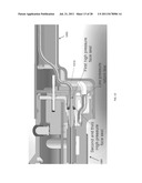 VAGINAL REMODELING DEVICE AND METHODS diagram and image