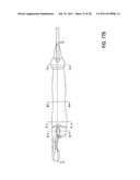 VAGINAL REMODELING DEVICE AND METHODS diagram and image