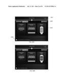 VAGINAL REMODELING DEVICE AND METHODS diagram and image