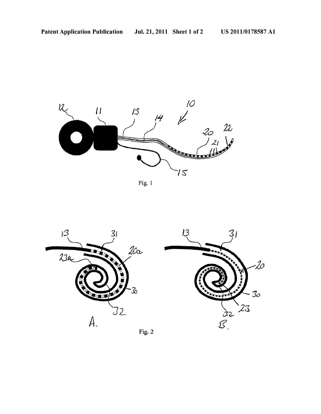 COCHLEAR IMPLANT WITH MODIFIED INTRACOCHLEAR ELECTRODE MEMBER - diagram, schematic, and image 02