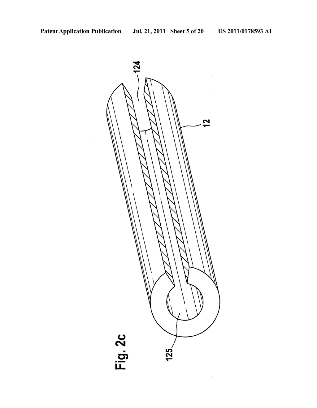 MEDICATION DEPOT FOR MEDICAL IMPLANTS - diagram, schematic, and image 06