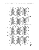 MEDICATION DEPOT FOR MEDICAL IMPLANTS diagram and image