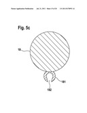 MEDICATION DEPOT FOR MEDICAL IMPLANTS diagram and image