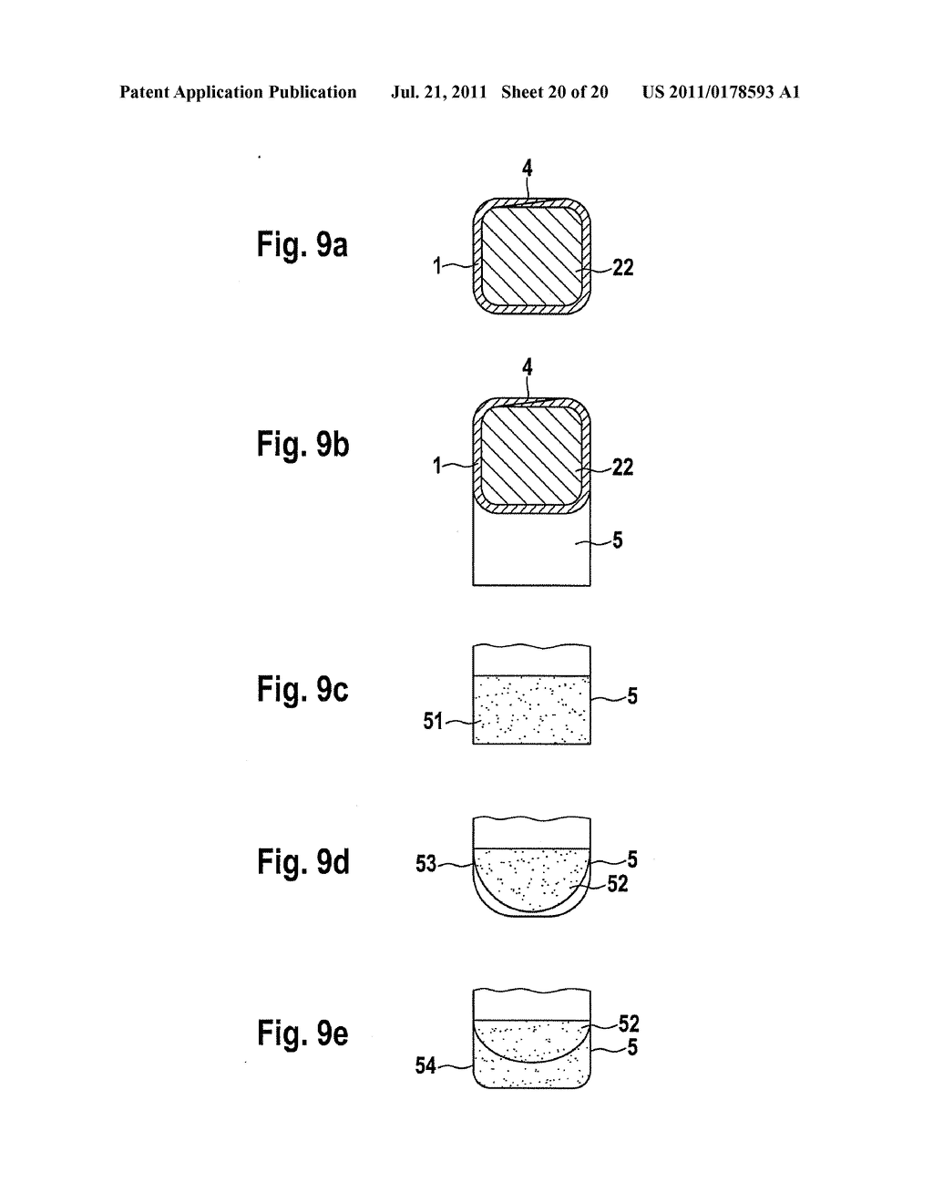 MEDICATION DEPOT FOR MEDICAL IMPLANTS - diagram, schematic, and image 21