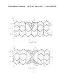 APPARATUS AND METHOD FOR REPLACING A DISEASED CARDIAC VALVE diagram and image