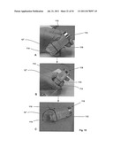 APPARATUS AND METHOD FOR REPLACING A DISEASED CARDIAC VALVE diagram and image