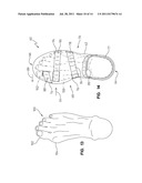 THERAPEUTIC FOOTWEAR diagram and image