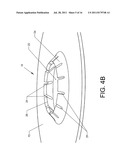 Device and method for securing a bolt in concrete diagram and image