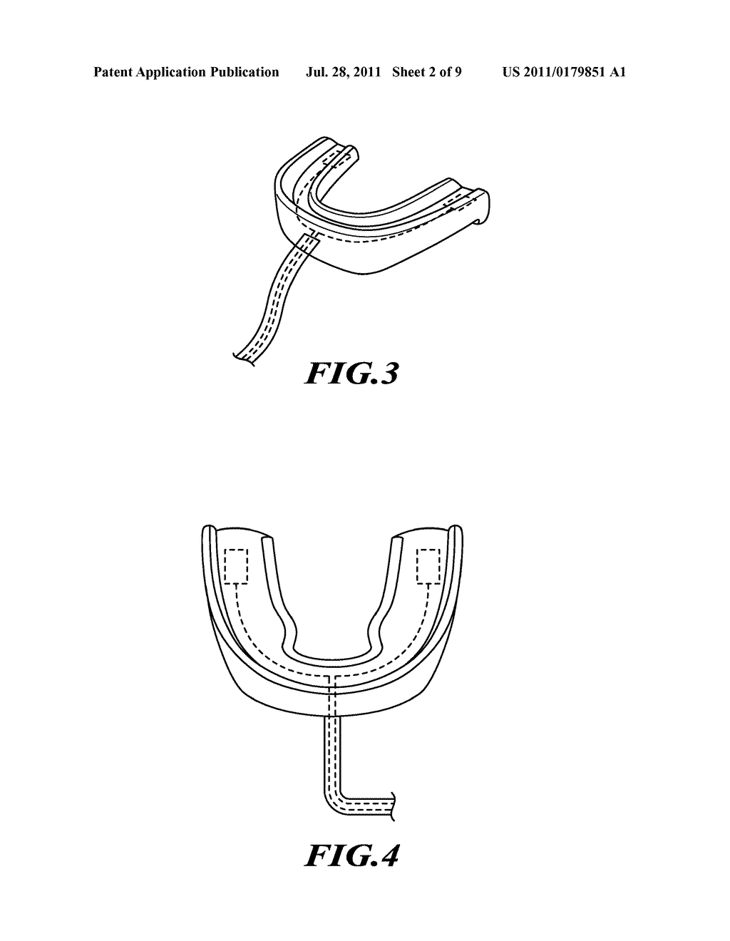 MOUTH GUARD FORMATION METHODS - diagram, schematic, and image 03