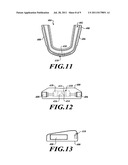 MOUTH GUARD FORMATION METHODS diagram and image