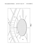 CLEANING DEVICE FOR ARTIFICIAL POOLS diagram and image