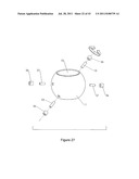 STEMLESS BALL VALVE diagram and image