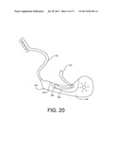 Vehicle Exterior Lighting System diagram and image