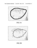 QUANTIFICATION METHOD OF THE FEATURE OF A TUMOR AND AN IMAGING METHOD OF     THE SAME diagram and image